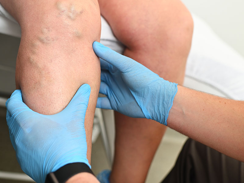 patient having a treatment