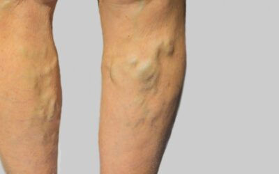 Clearing Up the Misconception: Why Are Veins Blue?