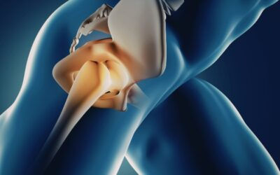 Advancements in Pain Management: The Promise of Genicular Artery Embolization
