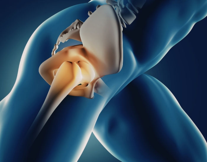 Advancements in Pain Management: The Promise of Genicular Artery Embolization