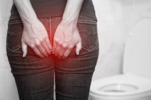 Doctor treating patient for hemorrhoids in Houston, TX