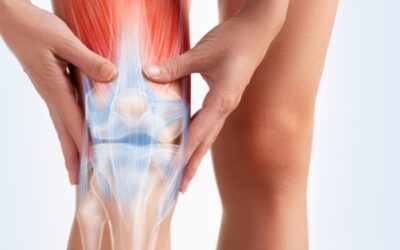 Arthritis of Knee Joint
