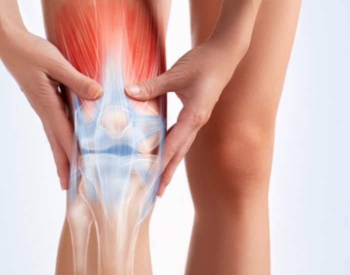 Arthritis of Knee Joint