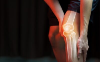 Inflammatory mediators of osteoarthritis of knee joint