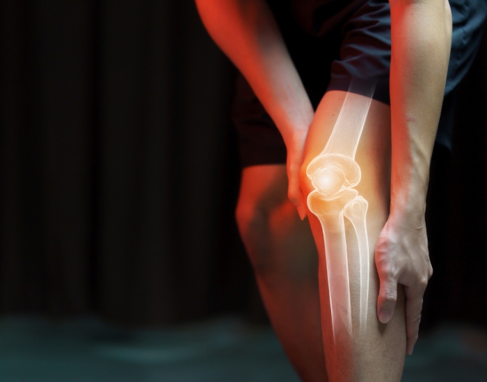 Inflammatory mediators of osteoarthritis of knee joint