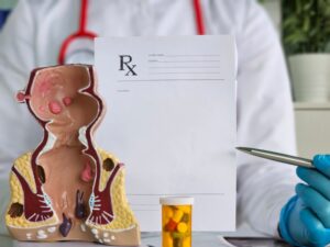 Internal Hemorrhoids Treatment in Houston, TX