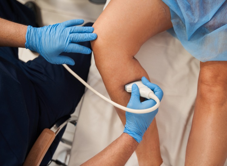 Ultrasound Procedure for Vein Assessment in Houston, TX