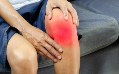 Can Varicose Veins Cause Joint Pain? Understanding the Connection