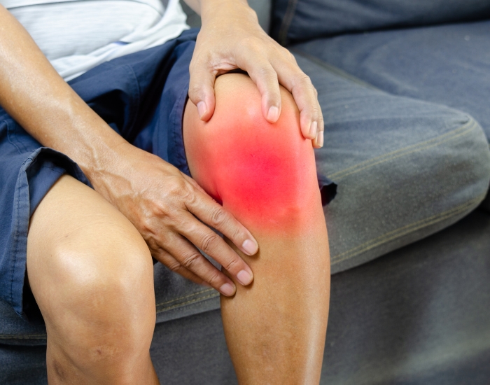 Can Varicose Veins Cause Joint Pain? Understanding the Connection