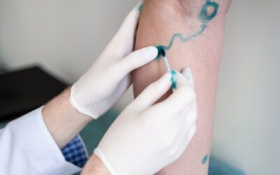 Ankles Swelling Every Evening: When to See an Evening Vein Specialist