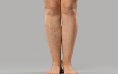 Heavy Feeling in the Legs: Causes, Symptoms & Solutions