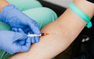 Minimally Invasive Vein Treatment Options Explained