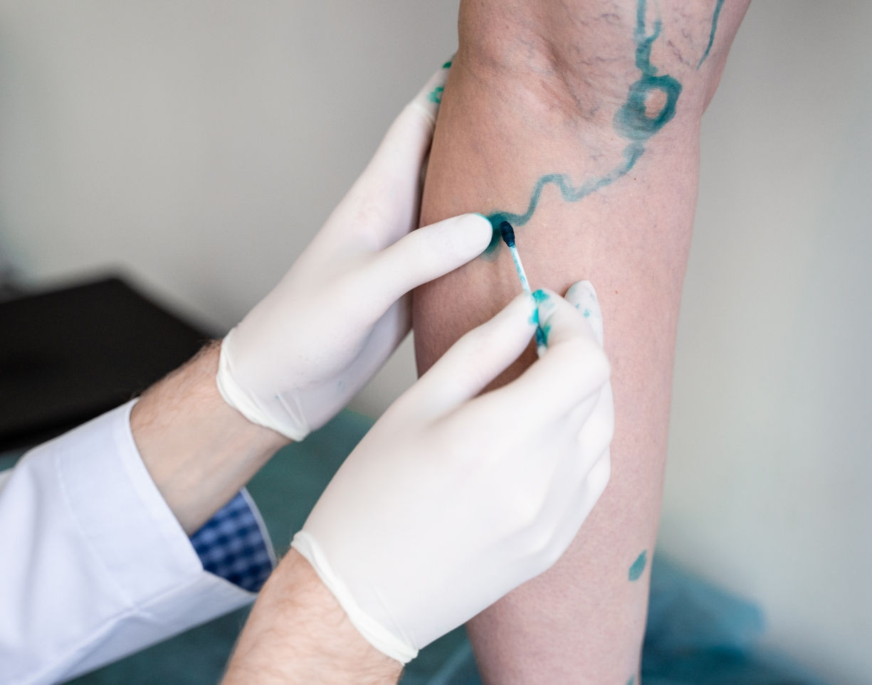 When Should I See a Vein Doctor – Houston Vein Specialist Guide