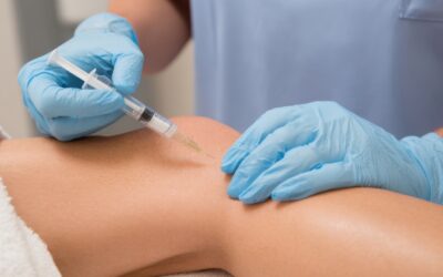 What’s the Best Vein Specialist Near Me in Houston?