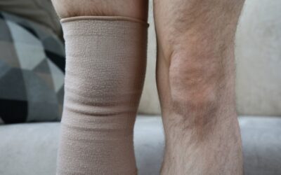 Aching Heavy Legs: Causes, Symptoms, and Effective Treatment Options