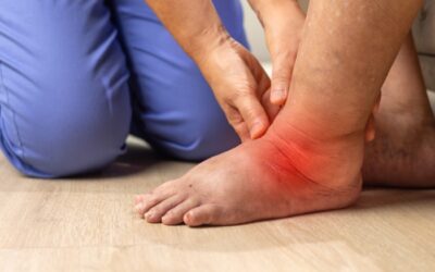 Why Is One Leg More Swollen Than the Other? Causes & When to See a Vein Specialist