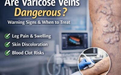 Are Varicose Veins Dangerous? Warning Signs You Shouldn’t Ignore